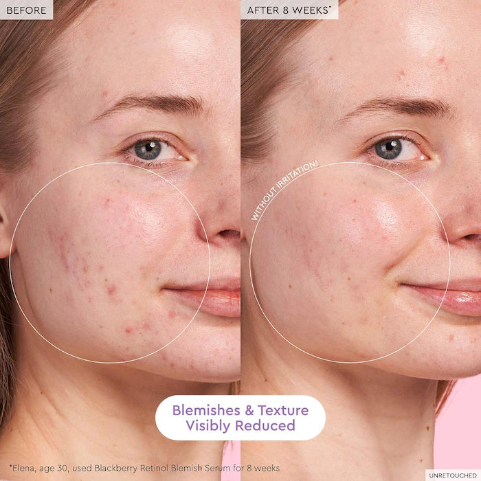 Glow Recipe 🫐Blackberry Retinol Blemish Serum