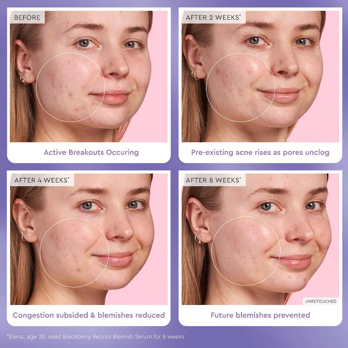 Glow Recipe 🫐Blackberry Retinol Blemish Serum