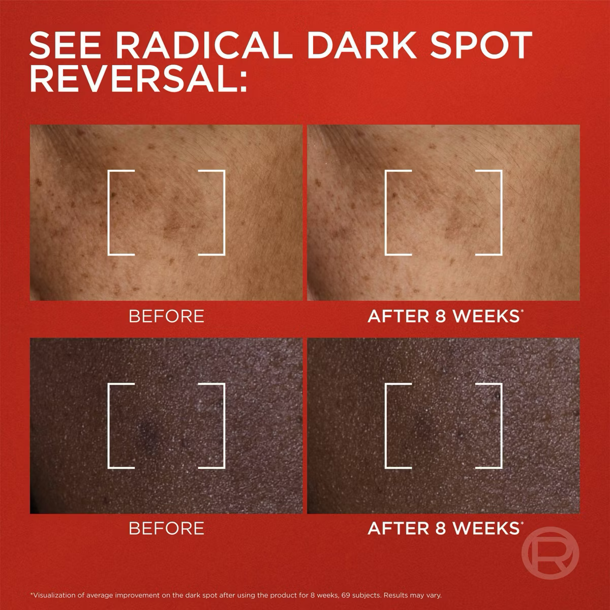 L'Oreal Paris Revitalift Triple Power Melasyl Dark Spot Moisturizing Creamy-Serum