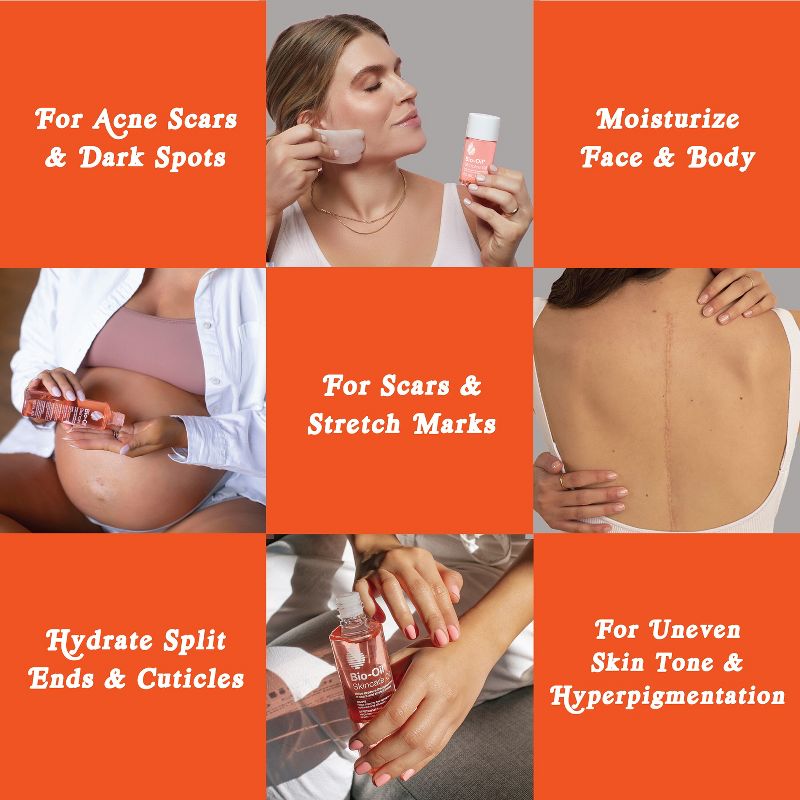 ✨Bio-Oil Skincare Oil✨