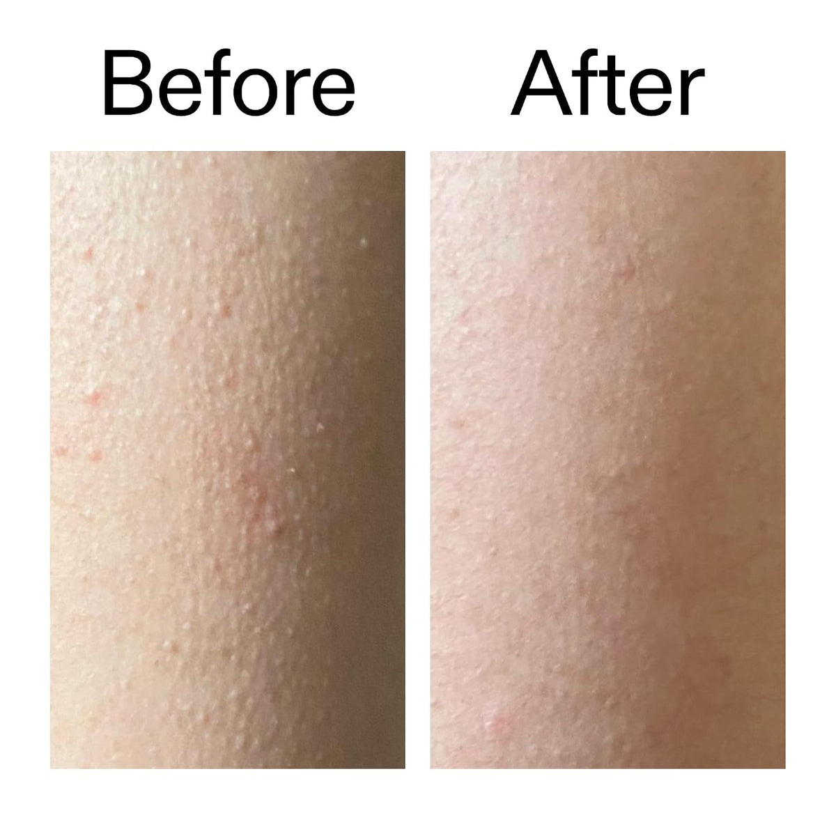 The INKEY List Glycolic Acid Exfoliating Body Stick