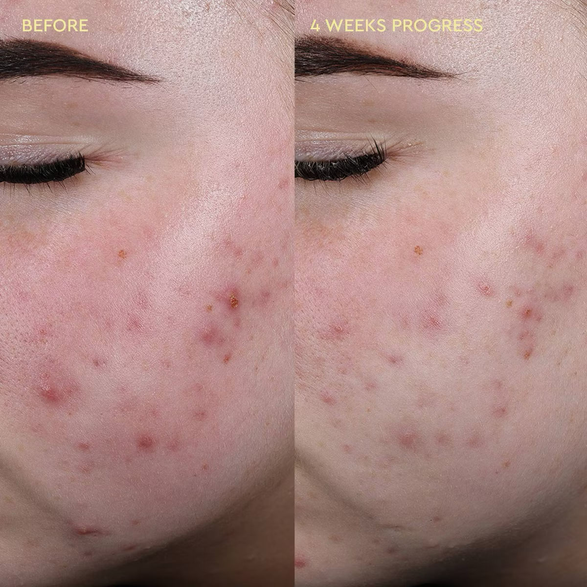 BYOMA Blemish Relief Soothing Mist Facial Toner